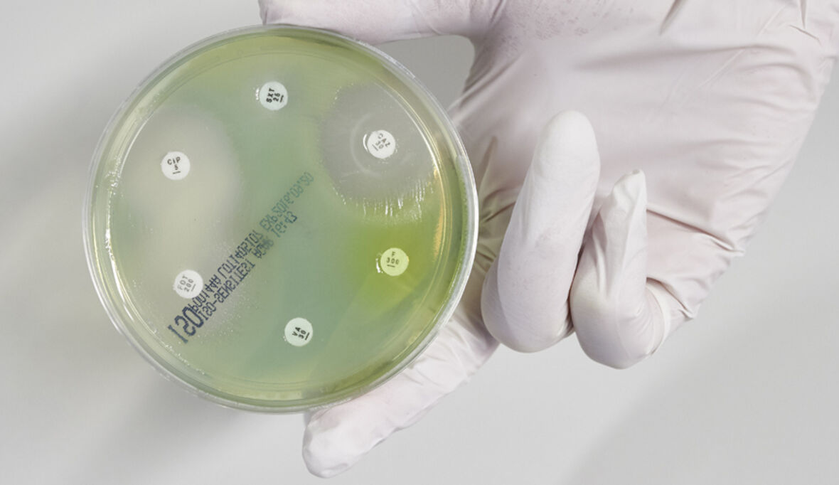 Tödliche Erreger in Pharma-Wirkstoffen – Verantwortung geht anders!