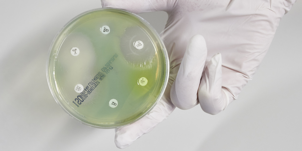 Tödliche Erreger in Pharma-Wirkstoffen – Verantwortung geht anders!