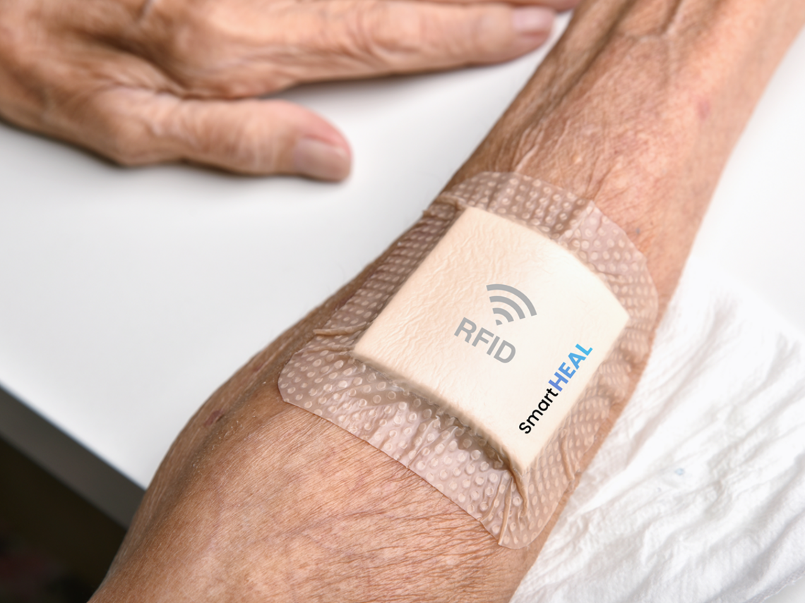 SmartHeal - präziser, erschwinglicher und skalierbarer intelligenter pH-Sensor, der in eine Wundauflage integriert ist und der Überwachung des Zustands chronischer Wunden dient.