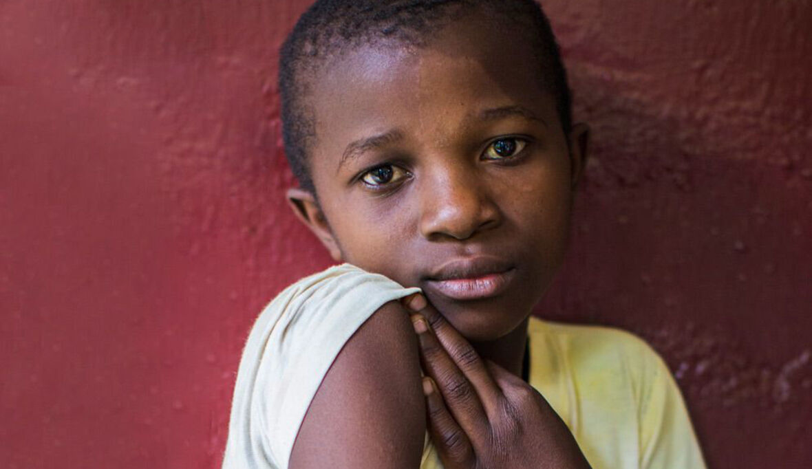 Welt-Lepra-Tag 2016: Novartis Stiftung seit 30 Jahren engagiert