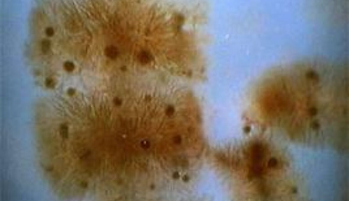 Exxon investiert in Biokraftstoffe aus Algen